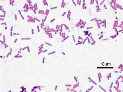 Bacilli - Wikipedia