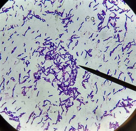 Bacillus. Large gram positive rod-shaped bacteria.