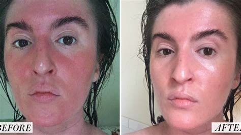 I Tried a Korean Skin-Care Routine for a Month - Before and After ...