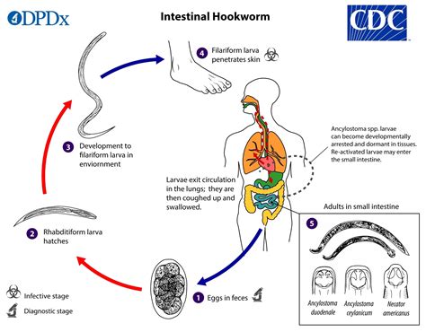 CDC - DPDx - Intestinal Hookworm