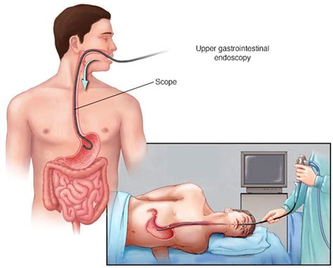 Endoscopy - Prep, Risks and Endoscopy Procedure