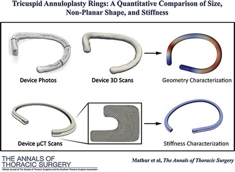 Tricuspid Annuloplasty Rings: A Quantitative Comparison of Size ...