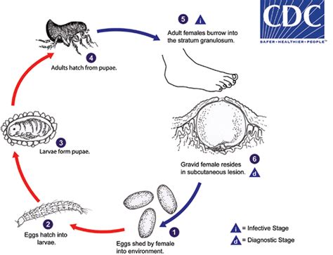 Tungiasis causes, symptoms, diagnosis, treatment & prognosis