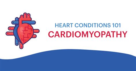 Cardiomyopathy: Symptoms, Causes, Diagnosis & Treatment - Cardiogram