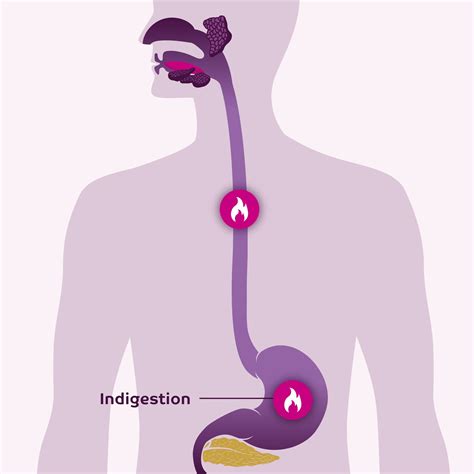 Indigestion (Dyspepsia): Causes & Treatment - Dr AvinashTank, is a ...