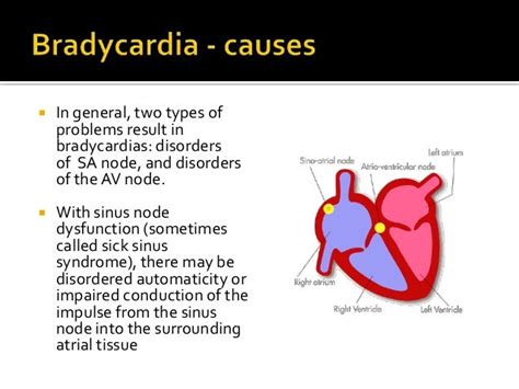 Bradycardia