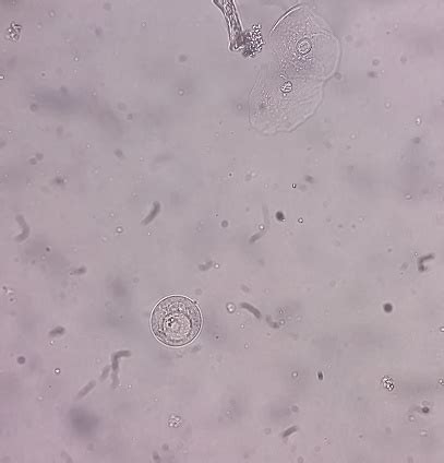 Hymenolepis Nana Egg Under 100x Light Microscope Hymenolepiasis Stock ...