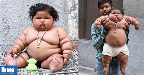 Morbidly obese baby girl alarms doctors by weighing in at nearly th ...