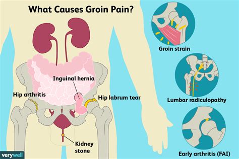 Groin Pain: Causes and When to Be Concerned