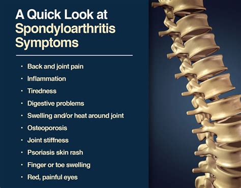 Spondyloarthritis - What is it? - Themovementmill