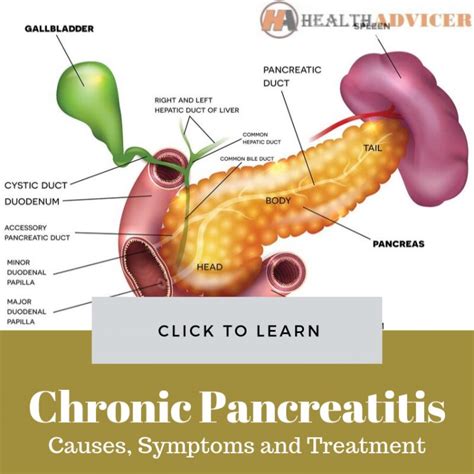 Chronic Pancreatitis: Causes, Picture, Symptoms And Treatment