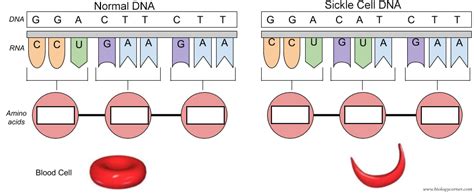 Sickle Cell Anemia Mutation