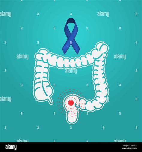 Colon Cancer vector logo icon illustration Stock Vector Image & Art - Alamy