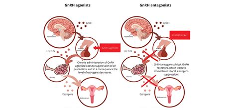 Understanding Gonadotropin Releasing Hormone Analogs: Mechanism ...