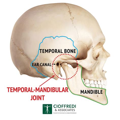 Treating TMJ - Cioffredi & Associates