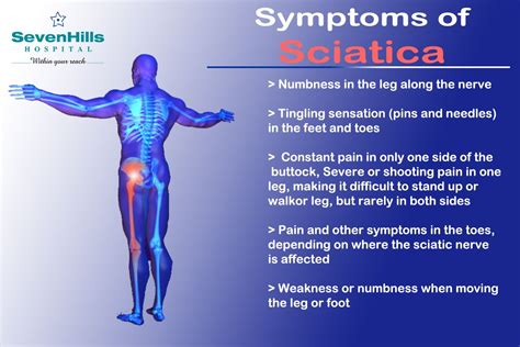 Symptoms Of Sciatica Buttock