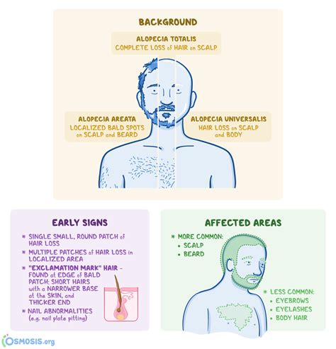 Alopecia: What It Is, Causes, Signs, and Treatment | Osmosis