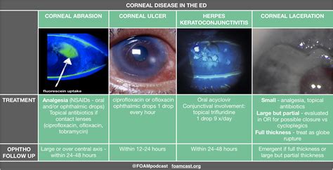 Corneal Emergencies | FOAMcast