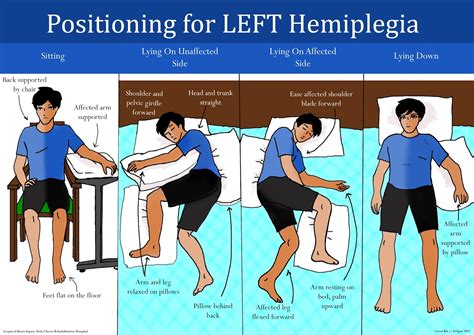 Carer Training Information: Positioning for Left Hemiplegia