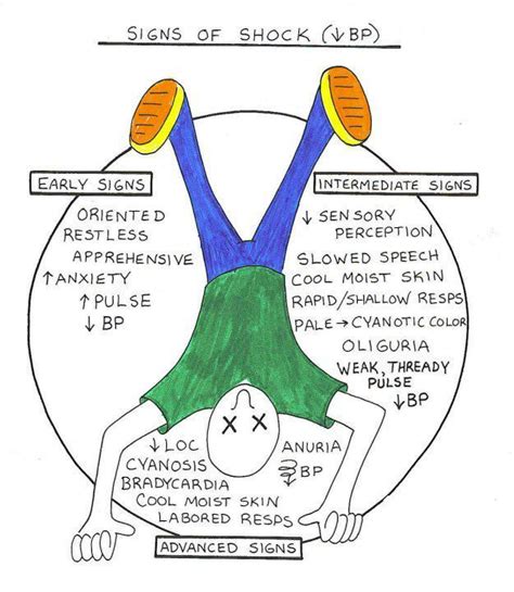 MD ☞ BP Shock. [More Cardiovascular Tips: https://pinterest.com ...