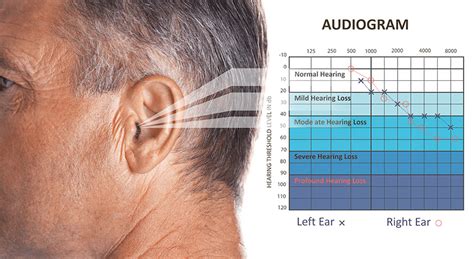 The Human Hearing Frequency Range and Audible Sounds | Nuheara