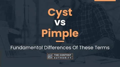 Cyst vs Pimple: Fundamental Differences Of These Terms