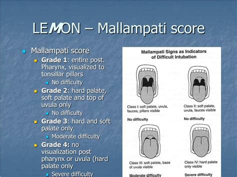 PPT - Airway Management PowerPoint Presentation, free download - ID:2809954