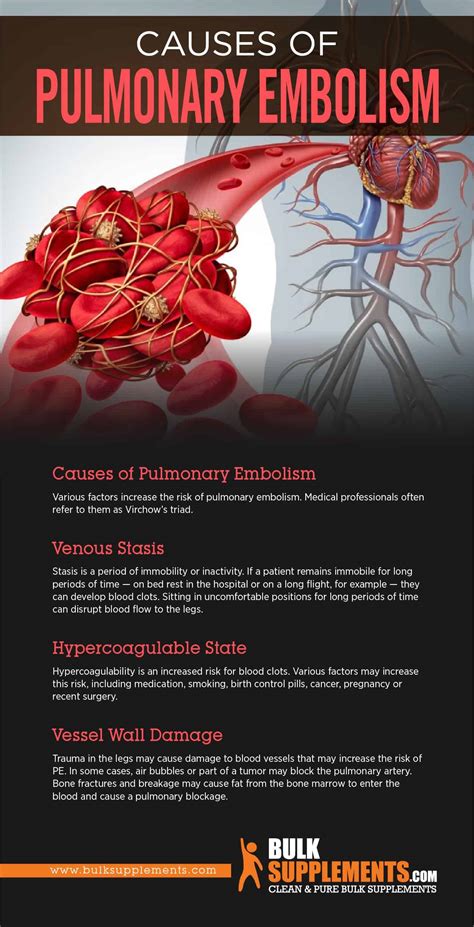 Tablo | Read 'Pulmonary Embolism: Causes, Symptoms & Treatment' by