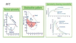 COPD vs Asthma. | PPT