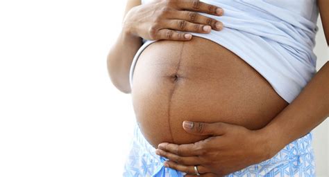 Linea nigra: When the pregnant belly line appears and why | BabyCenter