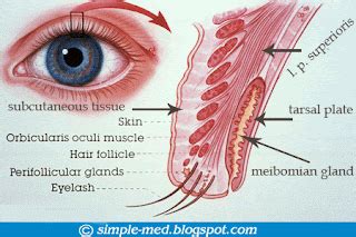 The Patient's Guide to Dry Eye Syndrome: Meibomian Gland Dysfunction ...