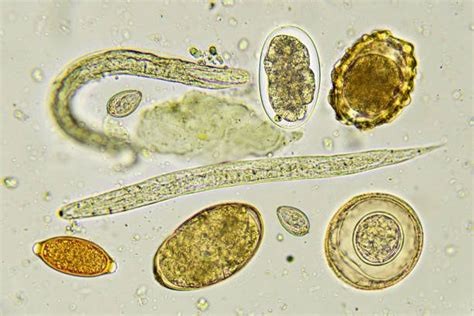 What Temperature Kills Threadworm Eggs? (Explained) - AnswerCatch