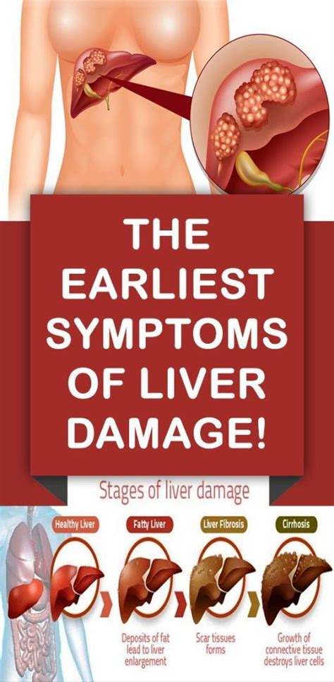 The Earliest Symptoms Of Liver Damage! | Healthy facts, Liver failure ...