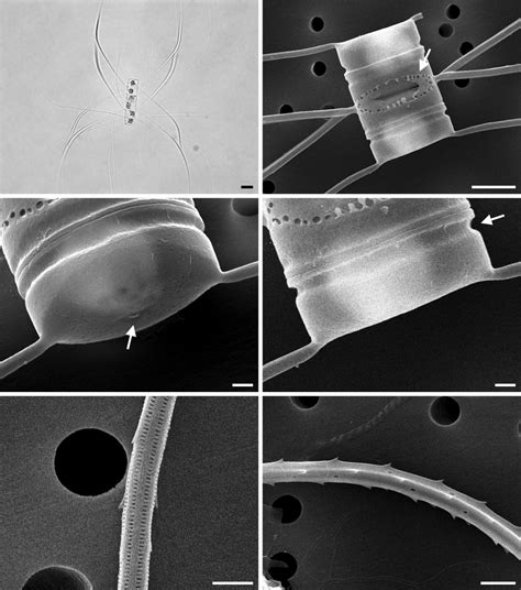 Chaetoceros diversus (A, light microscope; B-F, scanning electron ...