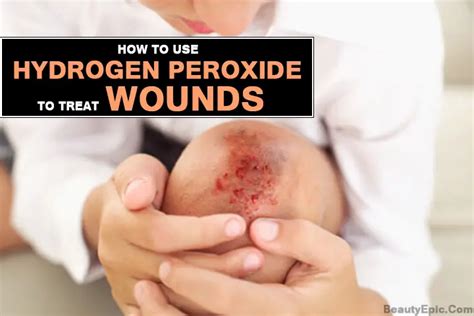 How to Use Hydrogen Peroxide to Treat Wounds?