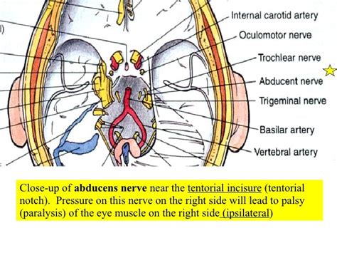 Superior Orbital Fissure Cranial Nerves