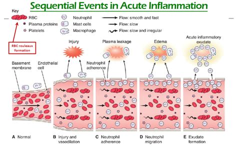 Chapter 2 - Inflammation and repair Diagram | Quizlet