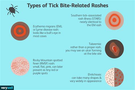 Tick Bite: Signs, Symptoms, and Complications