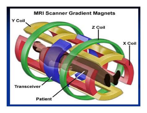 Inside the MRI: Gradient Coils | Amber Diagnostics