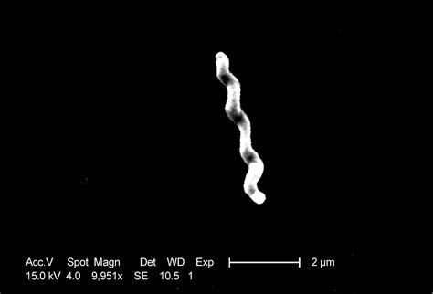 Campylobacter jejuni - wikidoc