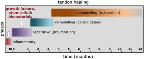 The tendon repair process in humans. The healing of ruptured tendons ...