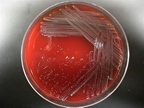 Corynebacterium Diphtheriae