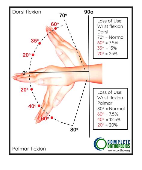 Upper Extremities – Hand and Wrist | Best Hip & Knee Surgeon | NY, USA