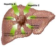 Liver Cancer (Hepatocellular Carcinoma) | Johns Hopkins Medicine