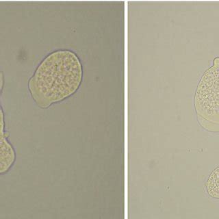 Entamoeba histolytica trophozoites observed under the microscope stain ...