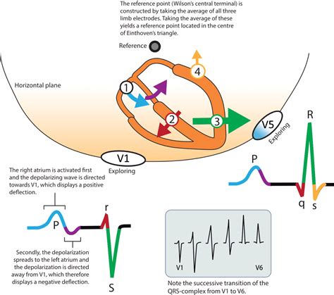 ECG interpretation: Characteristics of the normal ECG (P-wave, QRS ...