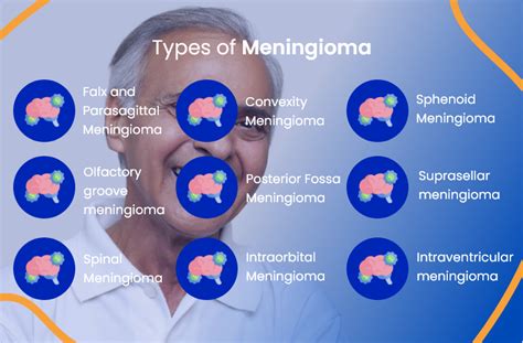 Meningioma: Types And Prognosis - Ask The Nurse Expert