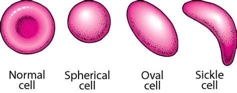 Figure: Red Blood Cell Shapes - MSD Manual Consumer Version