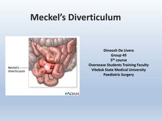 Merkel's diverticulum | PPT