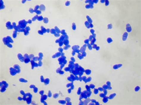 Microscopic image of a Malassezia spp. culture. Methylene blue staining ...